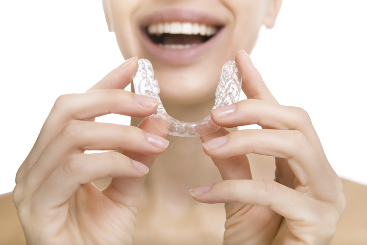 Invisalign Los Angeles